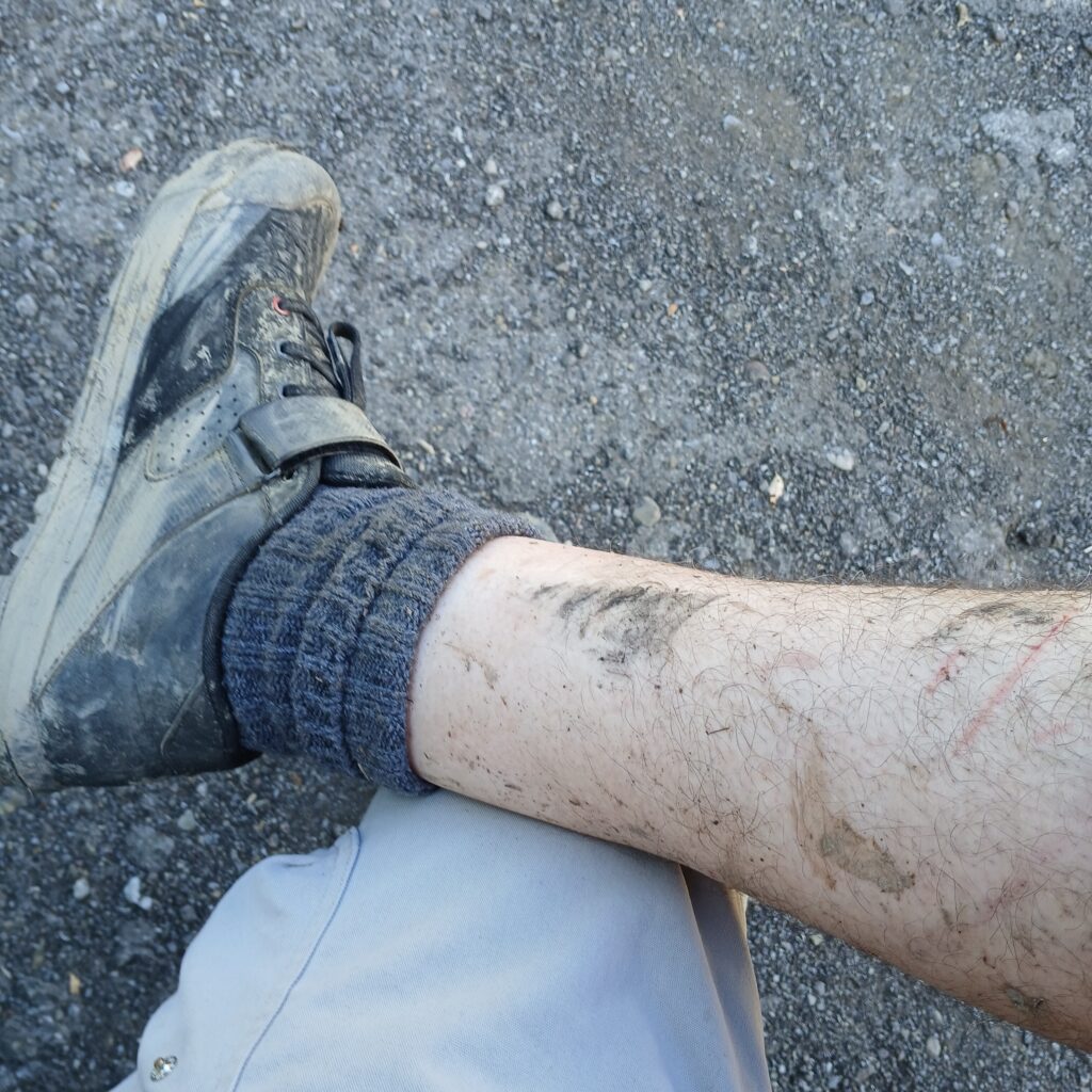 A mountain bikers filthy leg and shoe.